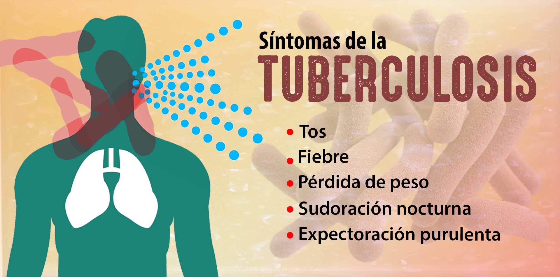 Tuberculosis